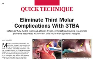0524TriAgenics_1.indd Third Molar Management article